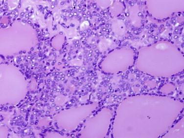 https://cdn.ncbi.nlm.nih.gov/pmc/blobs/e038/4353927/e9b4f507c727/gr2.jpg