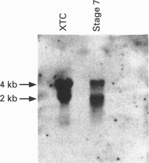https://cdn.ncbi.nlm.nih.gov/pmc/blobs/e03b/1135801/6f7a1e8f1030/biochemj00060-0077-b.jpg