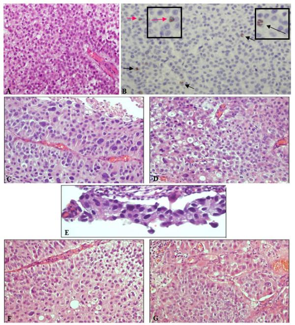 https://cdn.ncbi.nlm.nih.gov/pmc/blobs/e043/3598781/972cc3cd0699/1756-0500-5-607-1.jpg