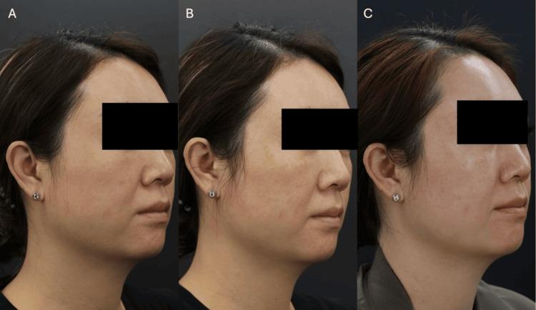 https://cdn.ncbi.nlm.nih.gov/pmc/blobs/e050/12344607/3ac6c3379396/cureus-0017-00000087878-i07.jpg