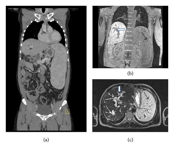 https://cdn.ncbi.nlm.nih.gov/pmc/blobs/e064/4207377/d421c732f8c3/CRII2014-804761.001.jpg