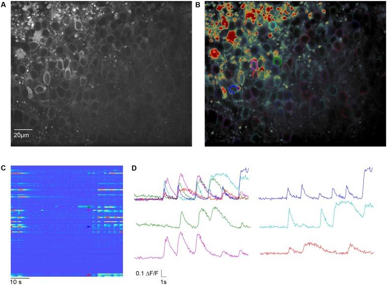 https://cdn.ncbi.nlm.nih.gov/pmc/blobs/e064/5489661/0e930eca44b8/fninf-11-00044-g004.jpg