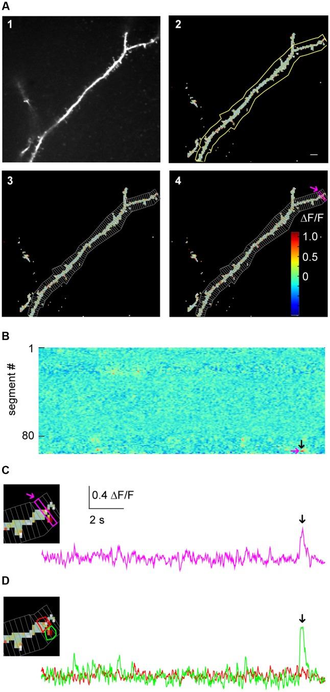 https://cdn.ncbi.nlm.nih.gov/pmc/blobs/e064/5489661/c38b512f6044/fninf-11-00044-g003.jpg