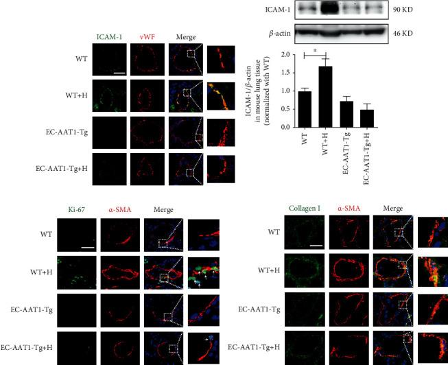 https://cdn.ncbi.nlm.nih.gov/pmc/blobs/e06c/8068783/daeebb7ae8ed/OMCL2021-5577634.002.jpg