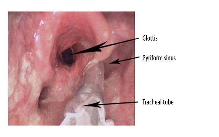 https://cdn.ncbi.nlm.nih.gov/pmc/blobs/e071/4186215/c3b2066daafc/medscimonit-20-1720-g003.jpg