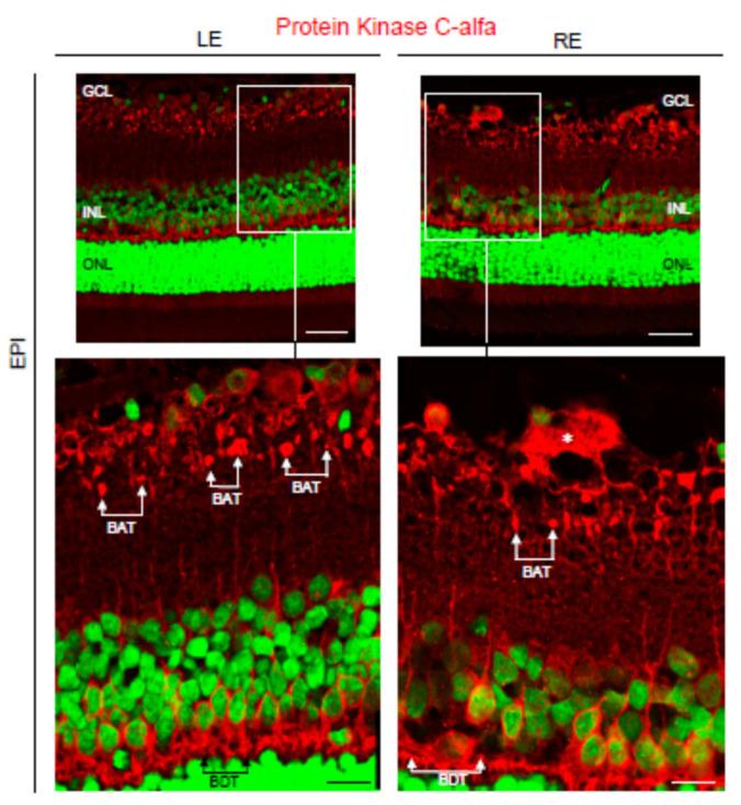 https://cdn.ncbi.nlm.nih.gov/pmc/blobs/e071/8235213/762bb6c2385d/biomedicines-09-00682-g012.jpg