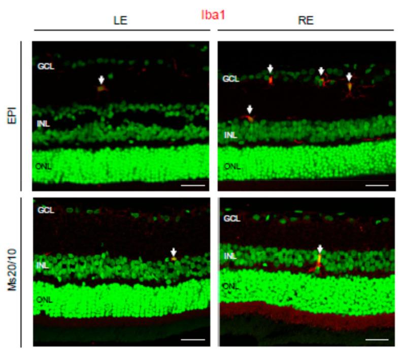 https://cdn.ncbi.nlm.nih.gov/pmc/blobs/e071/8235213/d35bc2e4ea7c/biomedicines-09-00682-g010.jpg