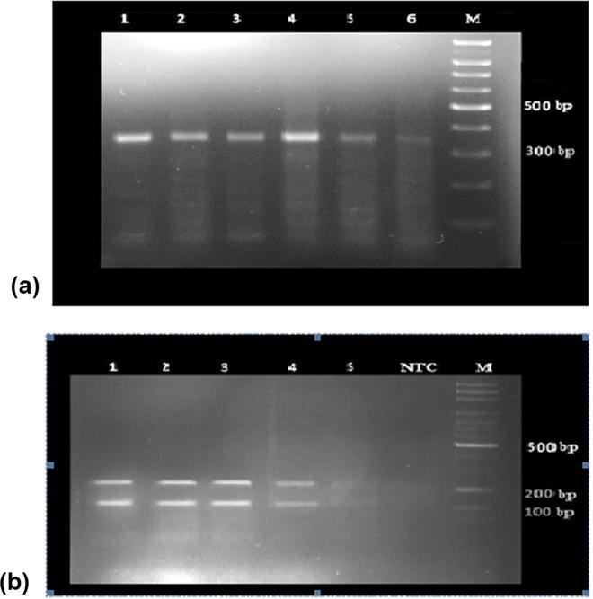 https://cdn.ncbi.nlm.nih.gov/pmc/blobs/e078/5004885/6edc65f7e0f9/pone.0161317.g005.jpg