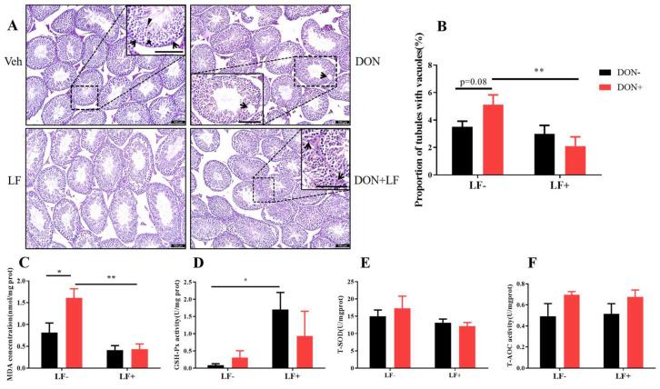 https://cdn.ncbi.nlm.nih.gov/pmc/blobs/e07c/9855165/d49e19564150/antioxidants-12-00152-g002.jpg