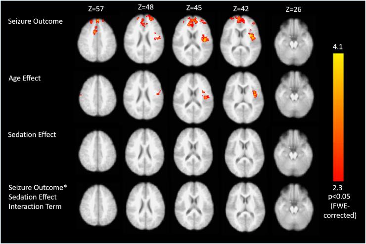 https://cdn.ncbi.nlm.nih.gov/pmc/blobs/e085/5619991/c48ec6511975/gr3.jpg