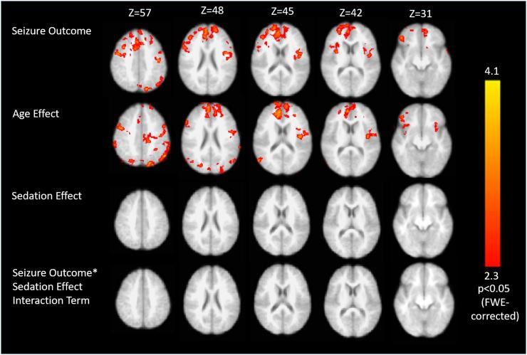 https://cdn.ncbi.nlm.nih.gov/pmc/blobs/e085/5619991/d97722175ed7/gr2.jpg