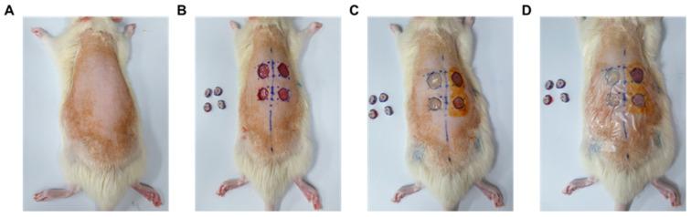 https://cdn.ncbi.nlm.nih.gov/pmc/blobs/e087/12026865/5ffe1e29674e/gels-11-00239-g006.jpg