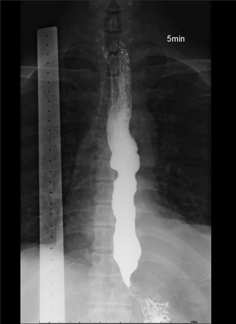 https://cdn.ncbi.nlm.nih.gov/pmc/blobs/e088/12278238/24ee6ec84296/wjgo-17-7-108162-g002.jpg