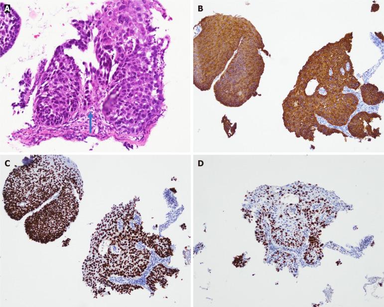 https://cdn.ncbi.nlm.nih.gov/pmc/blobs/e088/12278238/5d466d944c0f/wjgo-17-7-108162-g006.jpg
