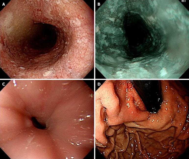 https://cdn.ncbi.nlm.nih.gov/pmc/blobs/e088/12278238/e26010a20af3/wjgo-17-7-108162-g001.jpg