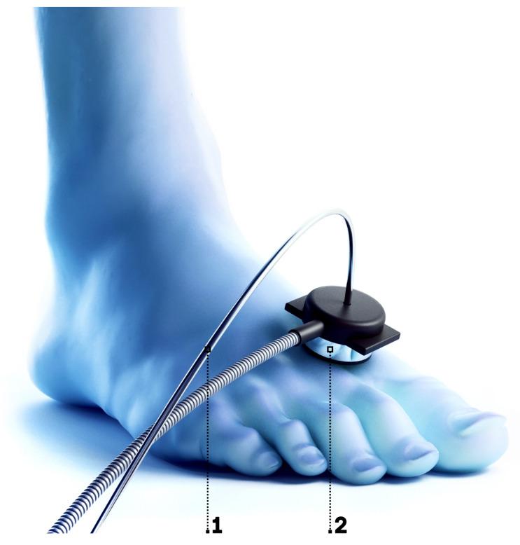 https://cdn.ncbi.nlm.nih.gov/pmc/blobs/e089/7916189/b38457baf210/diagnostics-11-00267-g004.jpg