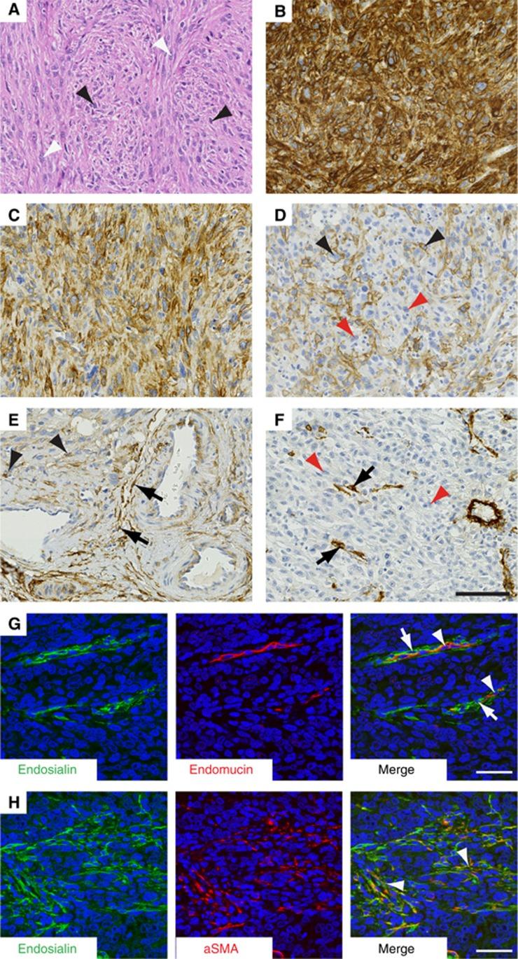 https://cdn.ncbi.nlm.nih.gov/pmc/blobs/e090/4985356/80d905e99970/bjc2016214f2.jpg
