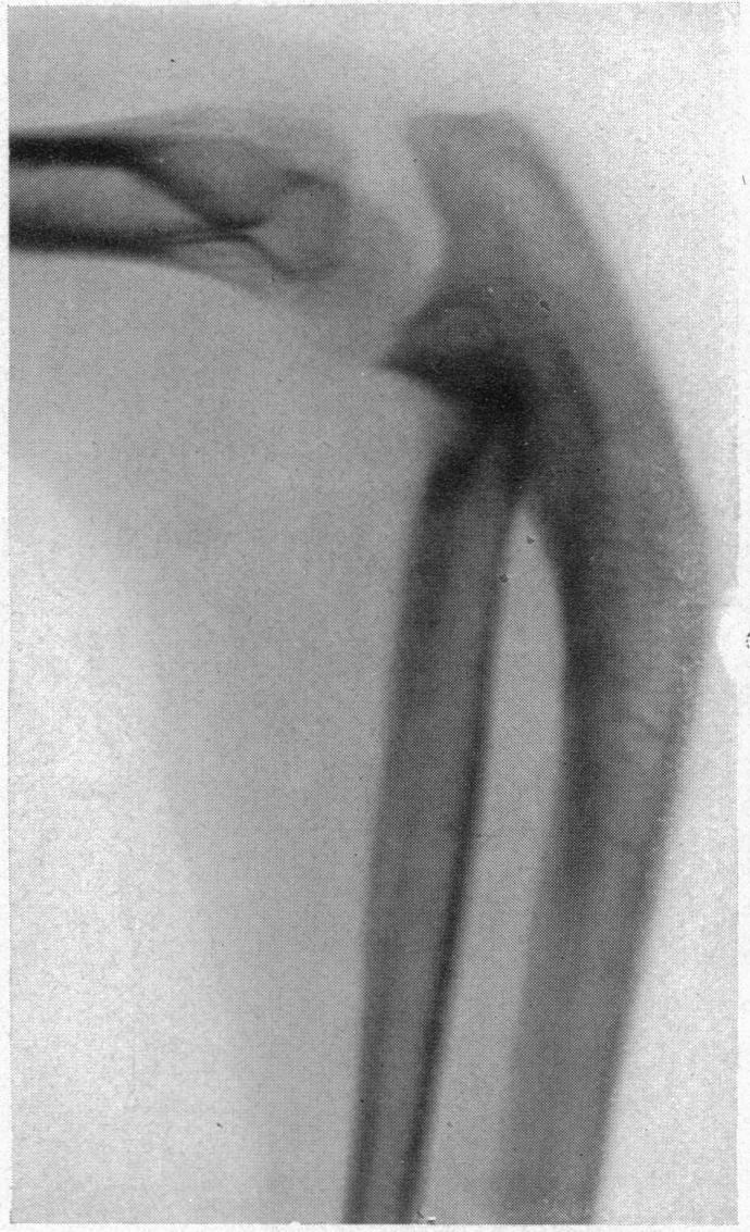 https://cdn.ncbi.nlm.nih.gov/pmc/blobs/e094/1398975/680cf750393c/annsurg00625-0112-b.jpg