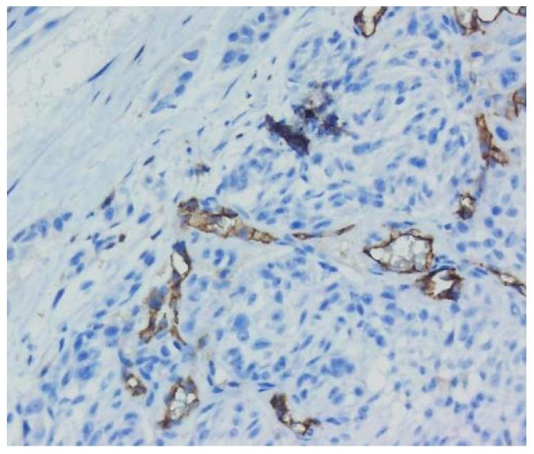 https://cdn.ncbi.nlm.nih.gov/pmc/blobs/e097/9599614/0271b26ab613/biomedicines-10-02500-g010.jpg