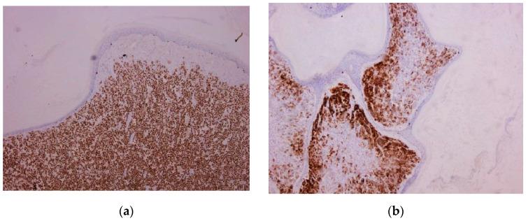 https://cdn.ncbi.nlm.nih.gov/pmc/blobs/e097/9599614/0f9051bf522f/biomedicines-10-02500-g006.jpg
