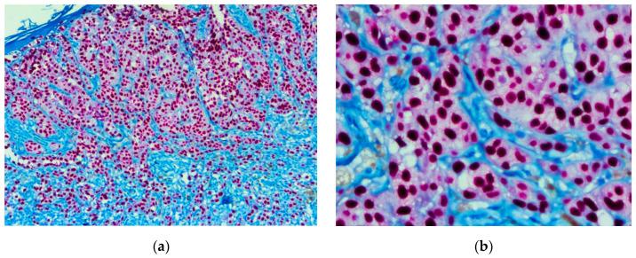 https://cdn.ncbi.nlm.nih.gov/pmc/blobs/e097/9599614/16a0b64c00ea/biomedicines-10-02500-g002.jpg