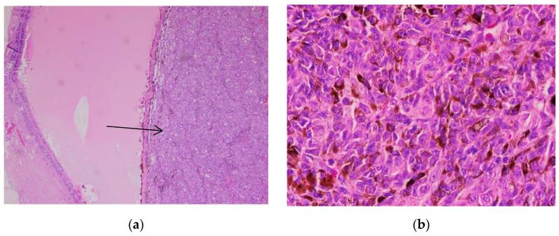 https://cdn.ncbi.nlm.nih.gov/pmc/blobs/e097/9599614/2ed02fa4534d/biomedicines-10-02500-g009.jpg