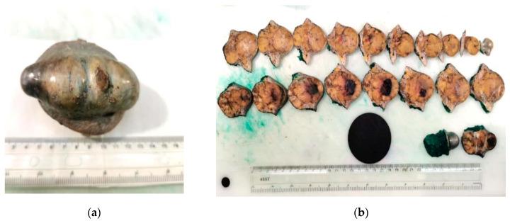https://cdn.ncbi.nlm.nih.gov/pmc/blobs/e097/9599614/7b130f75f25a/biomedicines-10-02500-g014.jpg