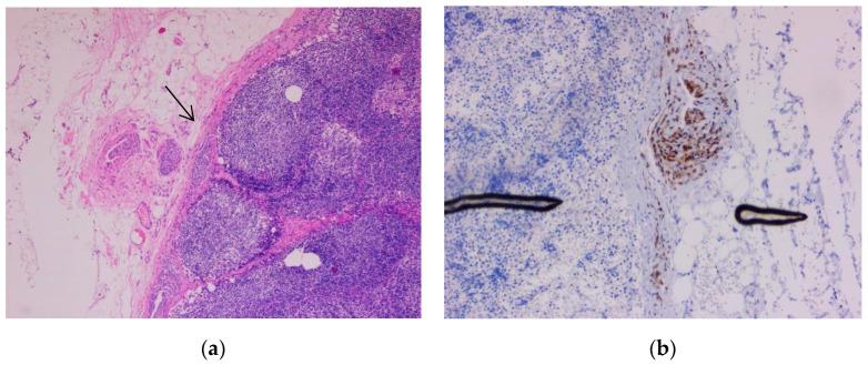 https://cdn.ncbi.nlm.nih.gov/pmc/blobs/e097/9599614/c3d458f387c4/biomedicines-10-02500-g013.jpg
