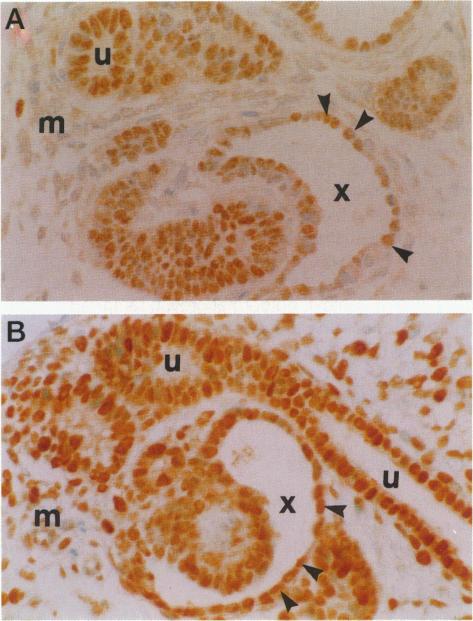 https://cdn.ncbi.nlm.nih.gov/pmc/blobs/e09c/1858586/4650358a5ecc/amjpathol00017-0127-a.jpg