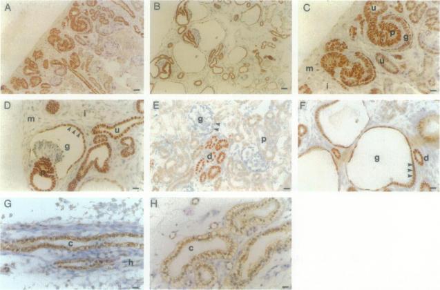 https://cdn.ncbi.nlm.nih.gov/pmc/blobs/e09c/1858586/b6b5c5a6ce40/amjpathol00017-0124-a.jpg