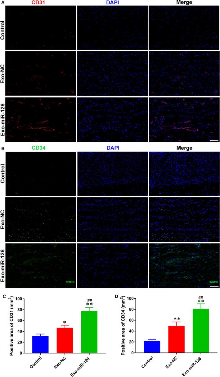 https://cdn.ncbi.nlm.nih.gov/pmc/blobs/e09c/7882955/0e86a187789d/JCMM-25-2148-g006.jpg