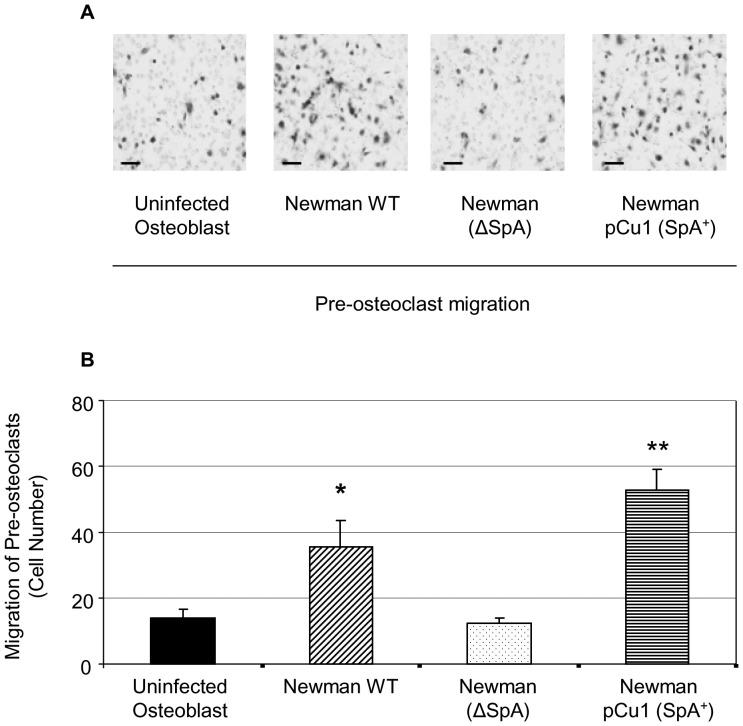 https://cdn.ncbi.nlm.nih.gov/pmc/blobs/e09f/3394727/4da071635900/pone.0040586.g004.jpg