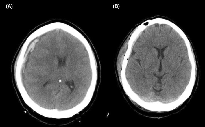 https://cdn.ncbi.nlm.nih.gov/pmc/blobs/e0a4/10064022/8b385fdf07e6/CCR3-11-e7170-g002.jpg