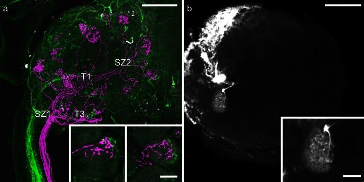 https://cdn.ncbi.nlm.nih.gov/pmc/blobs/e0a6/4148592/8553ea5ae3c7/441_2014_1892_Fig2_HTML.jpg