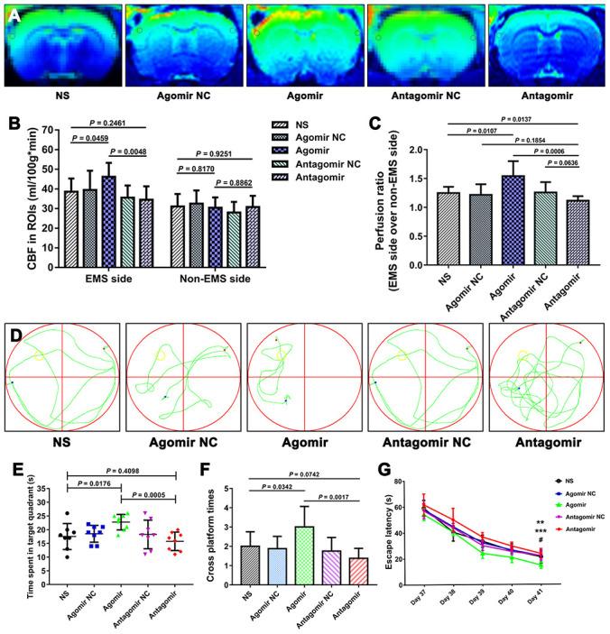 https://cdn.ncbi.nlm.nih.gov/pmc/blobs/e0aa/7377842/105bbdfe6ef4/aging-12-103431-g011.jpg