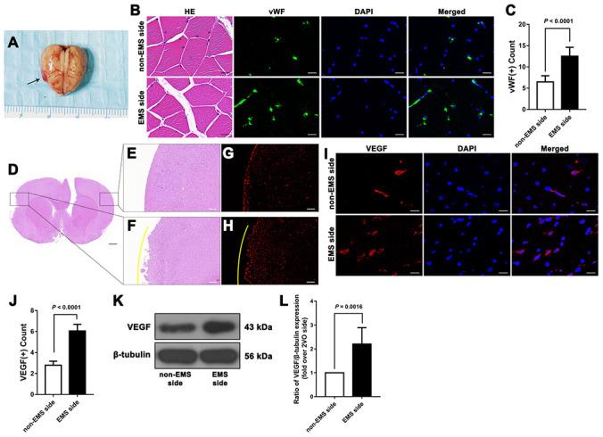 https://cdn.ncbi.nlm.nih.gov/pmc/blobs/e0aa/7377842/6ca60758e493/aging-12-103431-g004.jpg