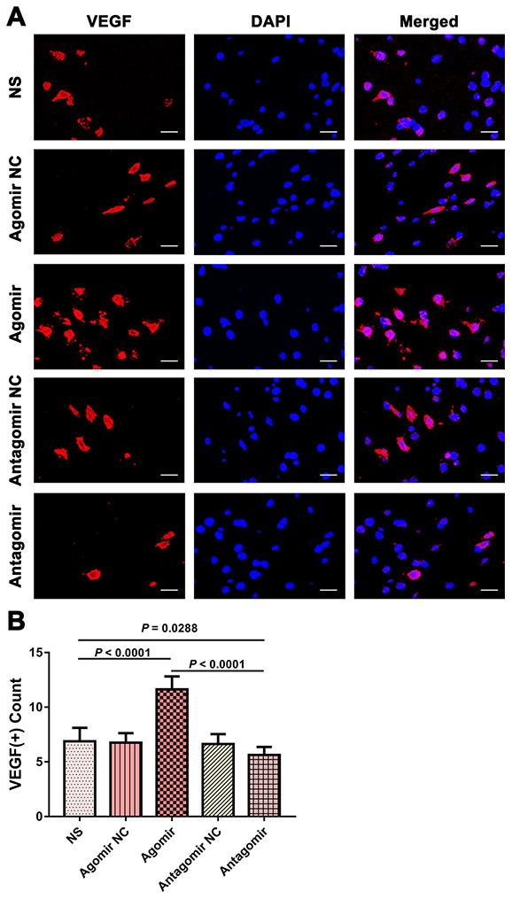 https://cdn.ncbi.nlm.nih.gov/pmc/blobs/e0aa/7377842/c8a369a335d2/aging-12-103431-g008.jpg