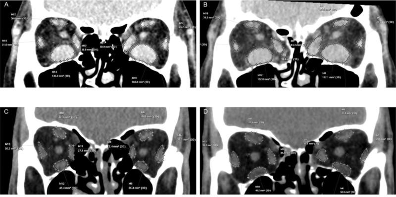 https://cdn.ncbi.nlm.nih.gov/pmc/blobs/e0ab/8009066/d532b2b9d218/cln-76-e2592-g003.jpg