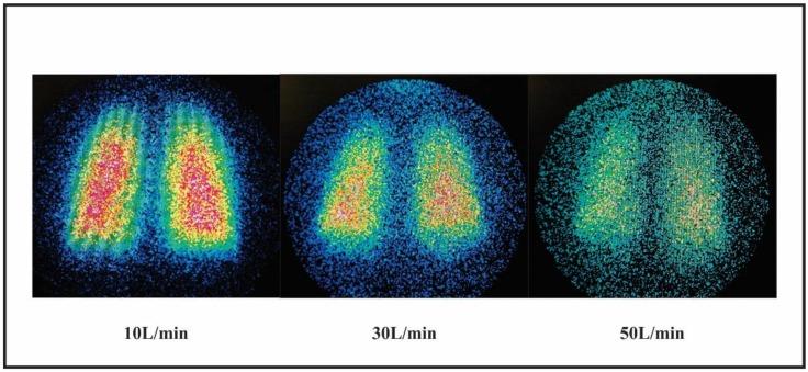 https://cdn.ncbi.nlm.nih.gov/pmc/blobs/e0ac/6680424/1d22c4f98838/pharmaceutics-11-00320-g003.jpg
