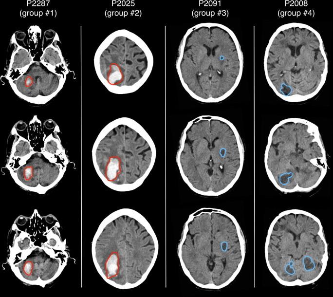 https://cdn.ncbi.nlm.nih.gov/pmc/blobs/e0b3/3984449/007c3051be67/gr7.jpg