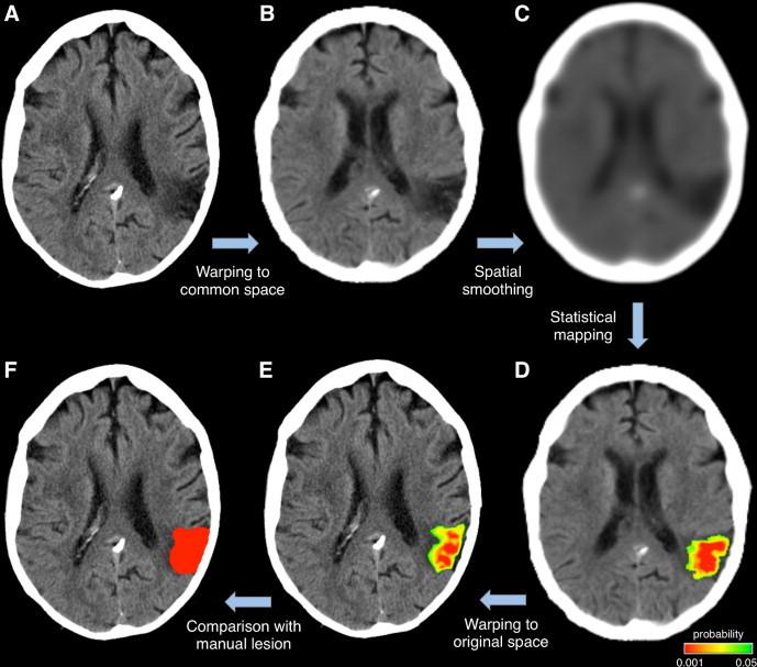 https://cdn.ncbi.nlm.nih.gov/pmc/blobs/e0b3/3984449/5d2ab257c93e/gr2.jpg