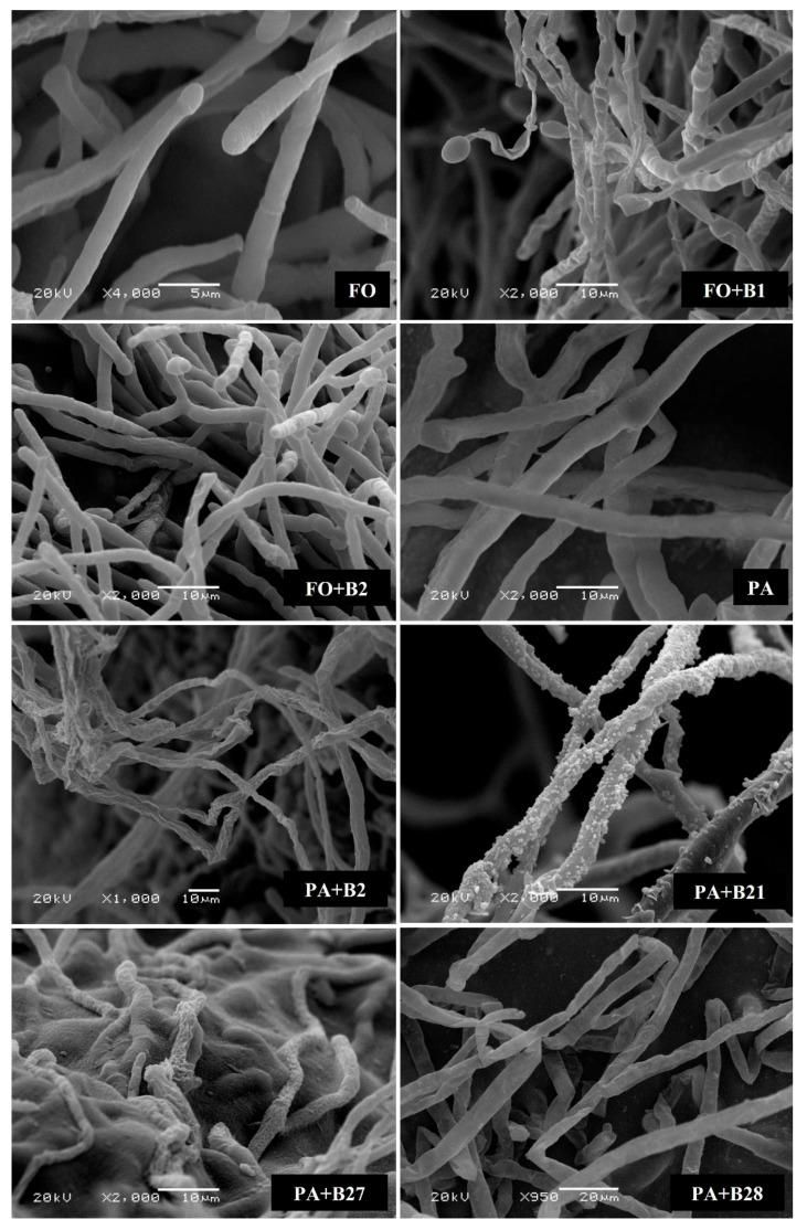 https://cdn.ncbi.nlm.nih.gov/pmc/blobs/e0b5/10674396/5dc731184d0f/pathogens-12-01275-g003.jpg