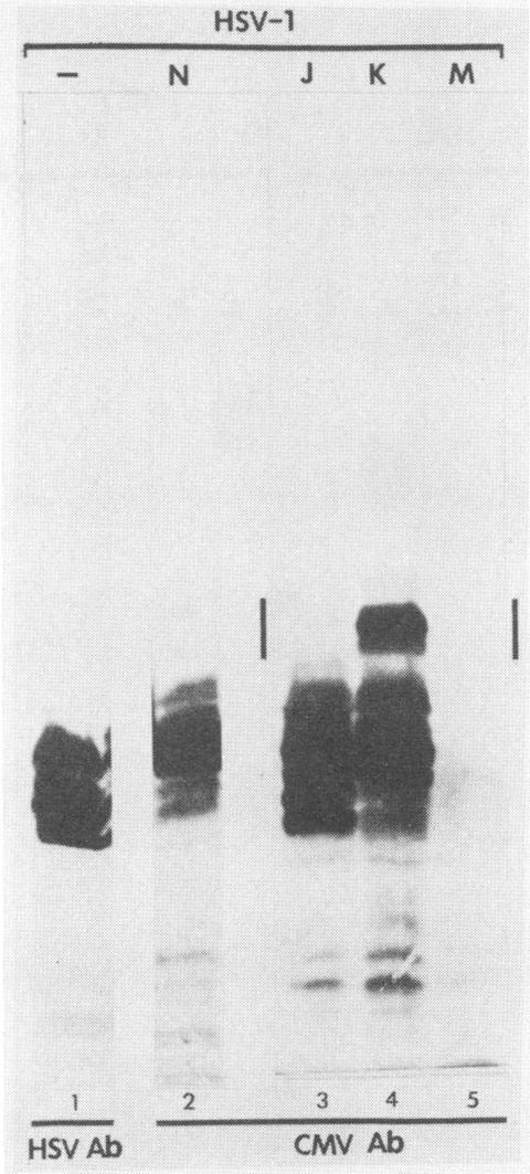 https://cdn.ncbi.nlm.nih.gov/pmc/blobs/e0b9/240506/595ca8f86945/jvirol00044-0232-a.jpg