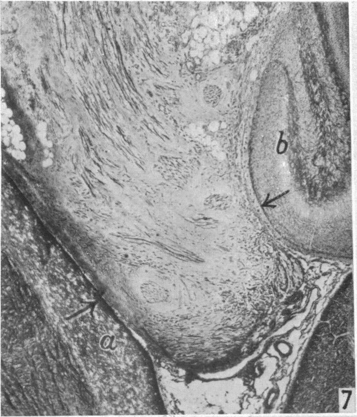 https://cdn.ncbi.nlm.nih.gov/pmc/blobs/e0bf/1252744/199dbe0742a6/janat00508-0077-a.jpg