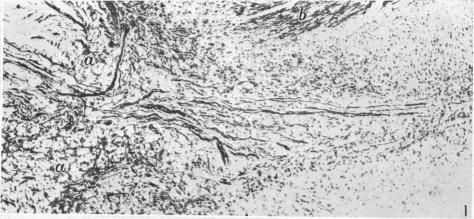 https://cdn.ncbi.nlm.nih.gov/pmc/blobs/e0bf/1252744/be2fb2d262de/janat00508-0076-a.jpg