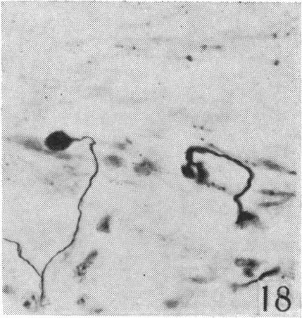 https://cdn.ncbi.nlm.nih.gov/pmc/blobs/e0bf/1252744/d2d671660bc6/janat00508-0078-d.jpg