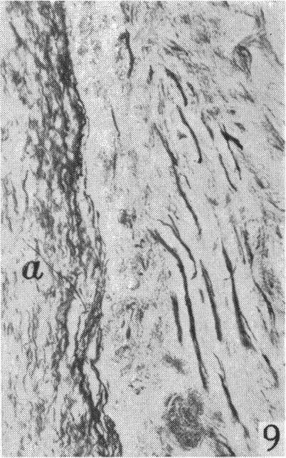https://cdn.ncbi.nlm.nih.gov/pmc/blobs/e0bf/1252744/e1edee96517c/janat00508-0077-c.jpg