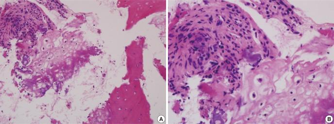 https://cdn.ncbi.nlm.nih.gov/pmc/blobs/e0d7/3617321/8cfe1e173446/jkms-28-631-g003.jpg