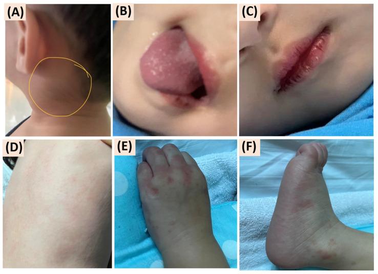 https://cdn.ncbi.nlm.nih.gov/pmc/blobs/e0d9/12199967/34ede8ad57bc/reports-07-00098-g001.jpg