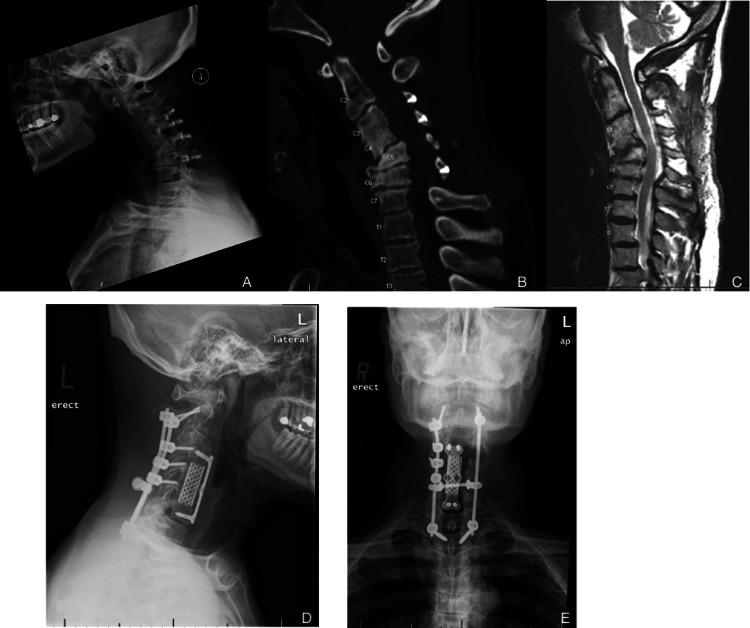 https://cdn.ncbi.nlm.nih.gov/pmc/blobs/e0da/12005606/6889a38cdcca/cureus-0017-00000080777-i03.jpg